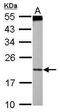 Programmed Cell Death 6 antibody, GTX102195, GeneTex, Western Blot image 