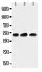 Hyaluronidase 1 antibody, PA5-79420, Invitrogen Antibodies, Western Blot image 