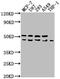 WD Repeat Domain 73 antibody, CSB-PA744047LA01HU, Cusabio, Western Blot image 