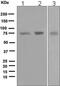 Protein Kinase C Zeta antibody, ab108970, Abcam, Western Blot image 