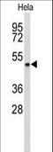 Alcohol Dehydrogenase 6 (Class V) antibody, LS-C156090, Lifespan Biosciences, Western Blot image 