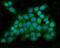 DnaJ Heat Shock Protein Family (Hsp40) Member C6 antibody, A05616-2, Boster Biological Technology, Immunofluorescence image 