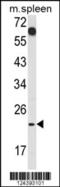 CD7 Molecule antibody, 64-085, ProSci, Western Blot image 