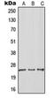 Rho GDP Dissociation Inhibitor Gamma antibody, orb213583, Biorbyt, Western Blot image 