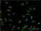 Splicing Factor Proline And Glutamine Rich antibody, H00006421-M01, Novus Biologicals, Immunocytochemistry image 