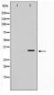 TNF Receptor Superfamily Member 6b antibody, TA347594, Origene, Western Blot image 