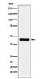 Abhydrolase Domain Containing 5 antibody, M03209, Boster Biological Technology, Western Blot image 
