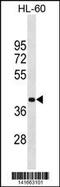 Methyl-CpG Binding Domain Protein 2 antibody, 60-764, ProSci, Western Blot image 