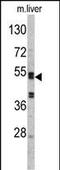 SERPINC1 antibody, A00469, Boster Biological Technology, Western Blot image 