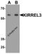 Kirre Like Nephrin Family Adhesion Molecule 3 antibody, 7973, ProSci, Western Blot image 