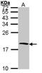 Cystatin S antibody, NBP1-32996, Novus Biologicals, Western Blot image 