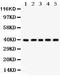 Cyclin Dependent Kinase 7 antibody, PB9536, Boster Biological Technology, Western Blot image 