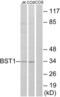 Bone Marrow Stromal Cell Antigen 1 antibody, abx014158, Abbexa, Western Blot image 