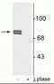 Arachidonate 5-Lipoxygenase antibody, P00847, Boster Biological Technology, Western Blot image 