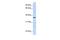 Transmembrane Protein 200B antibody, GTX46722, GeneTex, Western Blot image 