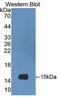 S100 Calcium Binding Protein A9 antibody, MBS2027867, MyBioSource, Western Blot image 