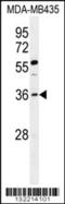 Forkhead Box E3 antibody, 56-258, ProSci, Western Blot image 