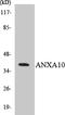 Annexin A10 antibody, LS-C200129, Lifespan Biosciences, Western Blot image 