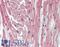 Natriuretic Peptide Receptor 1 antibody, LS-B15586, Lifespan Biosciences, Immunohistochemistry paraffin image 