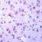 Glycogen Synthase Kinase 3 Alpha antibody, PA5-32440, Invitrogen Antibodies, Immunohistochemistry frozen image 