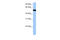 Tubulin alpha-3C/D chain antibody, 30-910, ProSci, Enzyme Linked Immunosorbent Assay image 