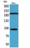 Neurotrophic Receptor Tyrosine Kinase 3 antibody, STJ96530, St John