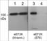 Eukaryotic Elongation Factor 2 Kinase antibody, EP4391, ECM Biosciences, Western Blot image 