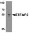 STEAP2 Metalloreductase antibody, A08410, Boster Biological Technology, Western Blot image 