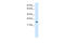 MYCL Proto-Oncogene, BHLH Transcription Factor antibody, ARP35770_T100, Aviva Systems Biology, Western Blot image 