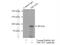 TBC1 Domain Family Member 5 antibody, 17078-1-AP, Proteintech Group, Immunoprecipitation image 