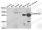 Serpin Family D Member 1 antibody, A5848, ABclonal Technology, Western Blot image 