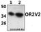 Olfactory Receptor Family 2 Subfamily V Member 2 antibody, GTX66811, GeneTex, Western Blot image 