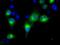 Retinol Dehydrogenase 11 antibody, NBP2-02431, Novus Biologicals, Immunofluorescence image 