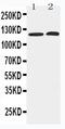 Histone Deacetylase 5 antibody, PA5-79352, Invitrogen Antibodies, Western Blot image 