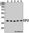 Prostaglandin E Receptor 2 antibody, GTX66706, GeneTex, Western Blot image 