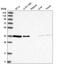 Vesicle Trafficking 1 antibody, HPA030969, Atlas Antibodies, Western Blot image 