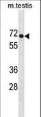 Phospholipase D Family Member 3 antibody, LS-C155805, Lifespan Biosciences, Western Blot image 