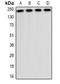 Complement C3b/C4b Receptor 1 (Knops Blood Group) antibody, orb382725, Biorbyt, Western Blot image 