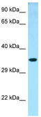 Nth Like DNA Glycosylase 1 antibody, TA338254, Origene, Western Blot image 