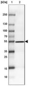 Coiled-Coil Domain Containing 173 antibody, NBP2-30925, Novus Biologicals, Western Blot image 