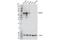 SMAD Family Member 4 antibody, 46535S, Cell Signaling Technology, Western Blot image 