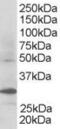 F-Box And WD Repeat Domain Containing 2 antibody, 45-583, ProSci, Enzyme Linked Immunosorbent Assay image 