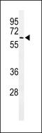 ALG10 Alpha-1,2-Glucosyltransferase antibody, LS-C156274, Lifespan Biosciences, Western Blot image 