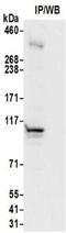 HDGF Like 2 antibody, NBP2-32069, Novus Biologicals, Immunoprecipitation image 
