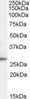 Tumor Protein D52 antibody, NBP1-06090, Novus Biologicals, Western Blot image 