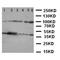 Nuclear Factor Kappa B Subunit 1 antibody, orb137914, Biorbyt, Western Blot image 