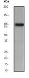 Vav Guanine Nucleotide Exchange Factor 2 antibody, ab52640, Abcam, Western Blot image 