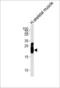 Troponin I2, Fast Skeletal Type antibody, LS-C160095, Lifespan Biosciences, Western Blot image 