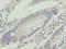Vacuolar Protein Sorting 25 Homolog antibody, LS-C398088, Lifespan Biosciences, Immunohistochemistry paraffin image 