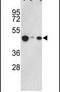 Histone Acetyltransferase 1 antibody, PA5-11215, Invitrogen Antibodies, Western Blot image 